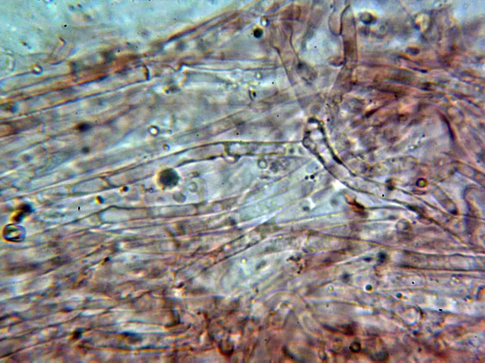 6 - Suprapellis 1